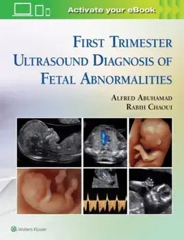 First Trimester Ultrasound Diagnosis of Fetal Abnormalities, Hardback/Rabih Chaoui