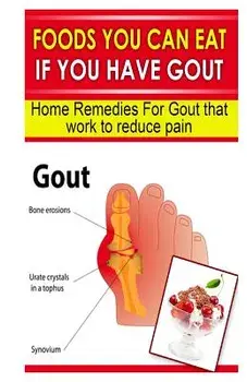 Foods You Can Eat If You Have Gout: Home Remedies for Gout That Work to Reduce Pain, Paperback/Doc Goodman