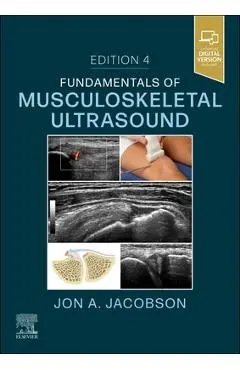 Fundamentals of Musculoskeletal Ultrasound - Jon A. Jacobson