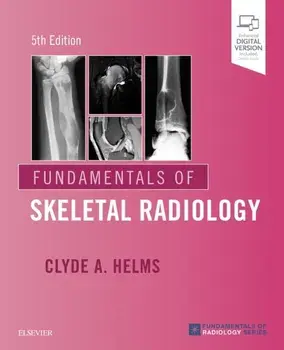 Fundamentals of Skeletal Radiology, Paperback/Clyde A. Helms