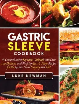 Gastric Sleeve Cookbook: A Comprehensive Bariatric Cookbook with Over 190 Delicious and Healthy Gastric Sleeve Recipes for the Gastric Sleeve S, Hardcover/Luke Newman
