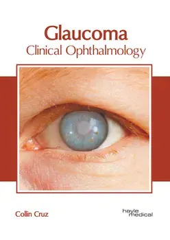 Glaucoma: Clinical Ophthalmology, Hardcover/Collin Cruz