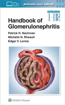 Handbook of Glomerulonephritis, Paperback/Michelle Rheault
