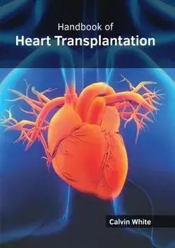 Handbook of Heart Transplantation, Hardcover/Calvin White