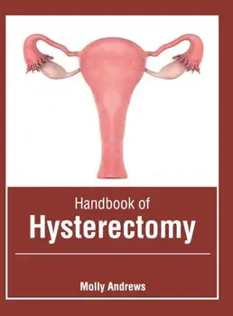 Handbook of Hysterectomy, Hardcover/Molly Andrews