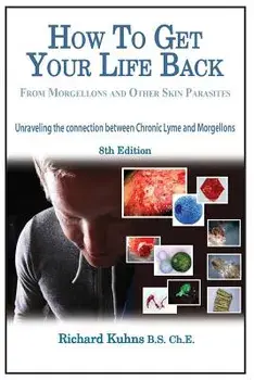 How to Get Your Life Back from Morgellons and Other Skin Parasites Limited Edit, Paperback/MR Richard L. Kuhns