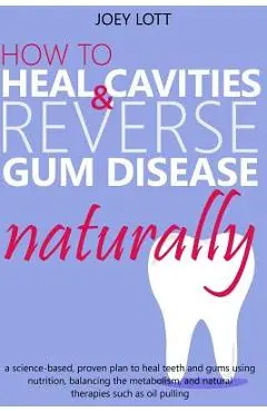How to Heal Cavities and Reverse Gum Disease Naturally: a science-based, proven plan to heal teeth and gums using nutrition, balancing the metabolism, - Joey Lott