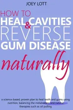 How to Heal Cavities and Reverse Gum Disease Naturally: A Science-Based, Proven Plan to Heal Teeth and Gums Using Nutrition, Balancing the Metabolism,, Paperback/Joey Lott