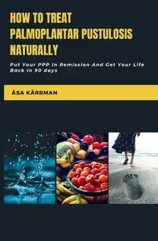 How To Treat Palmoplantar Pustulosis Naturally: Put Your PPP In Remission And Get Your Life Back!, Paperback/Åsa Kärrman