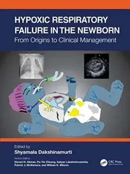 Hypoxic Respiratory Failure in the Newborn. From Origins to Clinical Management, Paperback/***