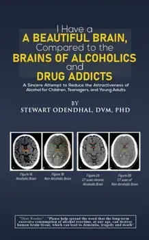 I Have a Beautiful Brain, Compared to the Brains of Alcoholics and Drug Addicts. A Sincere Attempt to Reduce the Attractiveness of Alcohol for Children, Teenagers, and Young Adults, Hardback/DVM, PhD, Stewart Odendhal