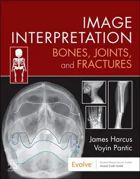 Image Interpretation: Bones, Joints, and Fractures, Paperback/Voyin Pantic