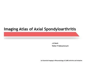 Imaging Atlas of Axial Spondyloarthritis, Paperback/J. O'Neill