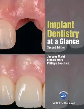 Implant Dentistry at a Glance, Paperback/Philippe Bouchard
