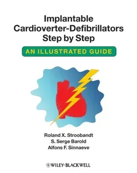 Implantable Cardioverter - Defibrillators Step by Step. An Illustrated Guide, Paperback/Alfons F. Sinnaeve