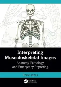 Interpreting Musculoskeletal Images. Anatomy, Pathology and Emergency Reporting, Paperback/***