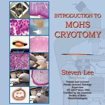 Introduction to Mohs Cryotomy, Paperback/Steven Lee