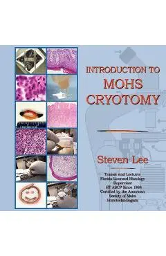 Introduction to MOHS Cryotomy - Steven Lee