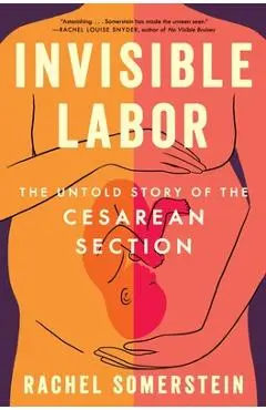 Invisible Labor: The Untold Story of the Cesarean Section - Rachel Somerstein