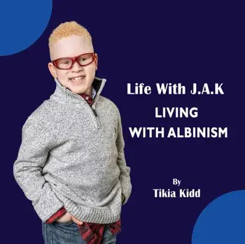 Life With J.A.K Living with Albinism: Living with Albinism, Paperback/***
