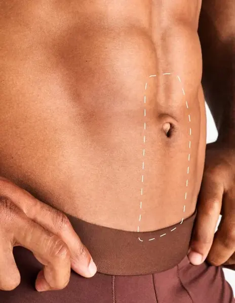 Linia mediană abdominală – Epilare Definitivă cu Laser - 1 Sedinta