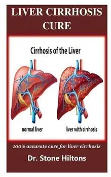 Liver Cirrhosis Cure: 100% accurate cure for liver cirrhosis, Paperback/Stone Hiltons