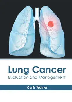 Lung Cancer: Evaluation and Management, Hardcover/Curtis Warner