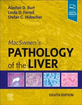 MacSween's Pathology of the Liver. 8 ed, Hardback/***