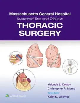 Massachusetts General Hospital Illustrated Tips and Tricks in Thoracic Surgery: Print + eBook with Multimedia, Paperback/***