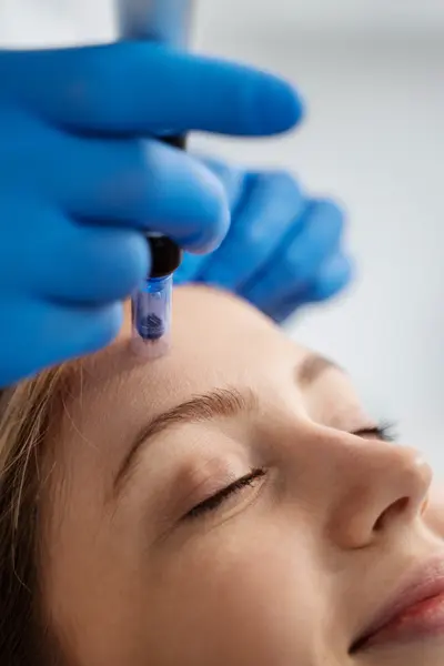 Microneedling – Față completă - Default Title