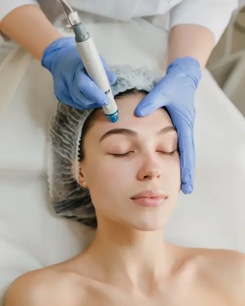 Microneedling – Gât - Default Title