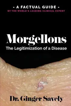 Morgellons: The Legitimization of a Disease: A Factual Guide by the World's Leading Clinical Expert, Paperback/Dr Ginger Savely