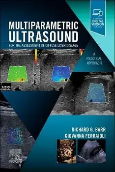 Multiparametric Ultrasound for the Assessment of Diffuse Liver Disease. A Practical Approach, Paperback/***