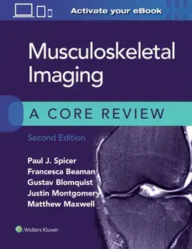 Musculoskeletal Imaging: A Core Review, Paperback/Matthew Maxwell