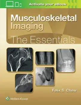 Musculoskeletal Imaging: The Essentials/Felix S. Chew