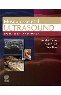 Musculoskeletal Ultrasound - Lorelei Waring
