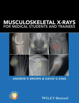 Musculoskeletal X-Rays for Medical Students and Trainees, Paperback/***