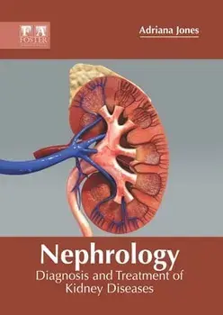 Nephrology: Diagnosis and Treatment of Kidney Diseases, Hardcover/Adriana Jones