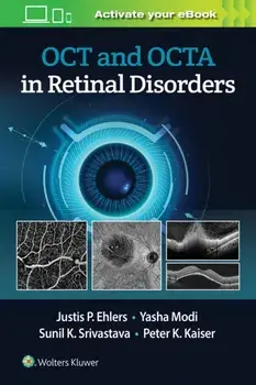 OCT and OCTA in Retinal Disorders, Paperback/Justis P. Ehlers