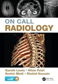 On Call Radiology, Paperback/***