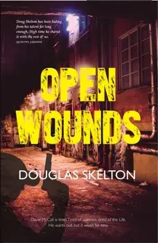 Open Wounds, Paperback/Douglas Skelton