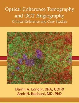 Optical Coherence Tomography and Oct Angiography: Clinical Reference and Case Studies/Cra Oct Landry