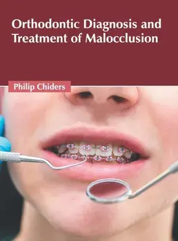Orthodontic Diagnosis and Treatment of Malocclusion, Hardcover/Philip Chiders