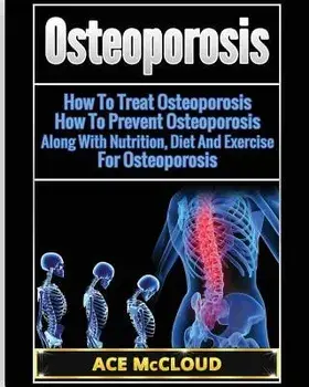 Osteoporosis: How to Treat Osteoporosis: How to Prevent Osteoporosis: Along with Nutrition, Diet and Exercise for Osteoporosis, Paperback/Ace McCloud