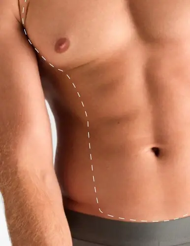Pachet Laser Bărbați: Piept & Abdomen - 1 Sedinte
