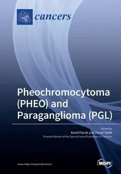 Pheochromocytoma (PHEO) and Paraganglioma (PGL), Paperback/Karel Pacak