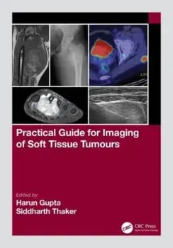 Practical Guide for Imaging of Soft Tissue Tumours, Paperback/***