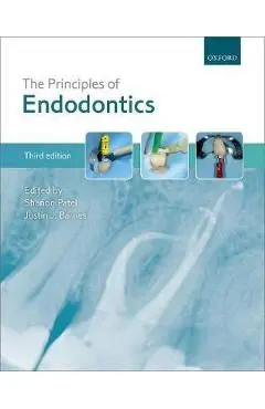 Principles of Endodontics - Shanon Patel