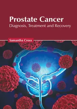 Prostate Cancer: Diagnosis, Treatment and Recovery, Hardcover/Samantha Cross