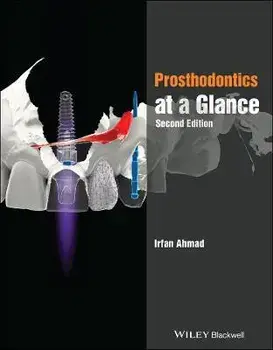 Prosthodontics at a Glance. 2nd Edition, Paperback/Irfan, BDS Ahmad